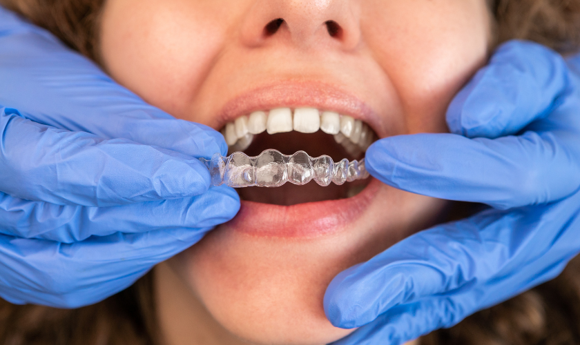 invisalign dentist addison