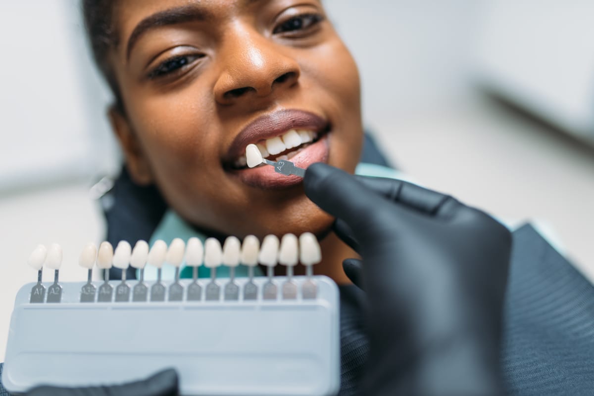 Veneers in Carrollton